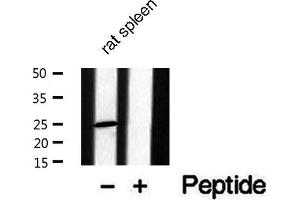 Western blot analysis of extracts from Rat spleen lysate, using CACNG1 antibody. (CACNG1 Antikörper  (Internal Region))