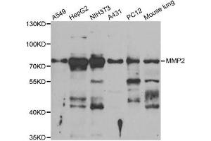 Western Blotting (WB) image for anti-Matrix Metalloproteinase 2 (MMP2) antibody (ABIN1882374) (MMP2 Antikörper)
