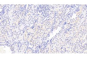 Detection of CSRP1 in Human Kidney Tissue using Polyclonal Antibody to Cysteine And Glycine Rich Protein 1 (CSRP1)
