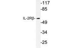 Western blot analysis of IL-2Rβ antibody in extracts from HepG2 cells. (IL2 Receptor beta Antikörper)