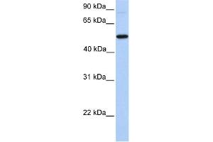 WB Suggested Anti-GALNT13 Antibody Titration:  0.