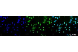 Immunocytochemistry/Immunofluorescence analysis using Rabbit Anti-Acetylated Lysine Polyclonal Antibody . (Lysine (lys) (acetylated) Antikörper (Atto 488))