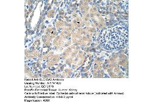 Rabbit Anti-SLC13A3 Antibody  Paraffin Embedded Tissue: Human Kidney Cellular Data: Epithelial cells of renal tubule Antibody Concentration: 4. (SLC13A3 Antikörper  (Middle Region))