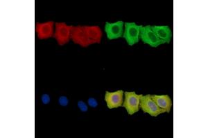 ENTPD6 Antibody staining Hela cells by IF/ICC.