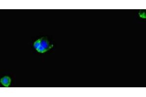 Immunofluorescent analysis of MCF-7 cells using ABIN7166656 at dilution of 1:100 and Alexa Fluor 488-congugated AffiniPure Goat Anti-Rabbit IgG(H+L) (LPAL2 Antikörper  (AA 52-124))
