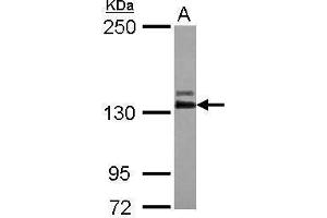 WB Image Sample (30 ug of whole cell lysate) A: IMR32 5% SDS PAGE antibody diluted at 1:1000 (ABL2 Antikörper  (Center))