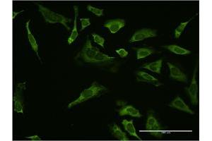 Immunofluorescence of monoclonal antibody to SP1 on HeLa cell. (SP1 Antikörper  (AA 522-618))