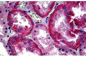 Human Kidney: Formalin-Fixed, Paraffin-Embedded (FFPE) (CD147 Antikörper)