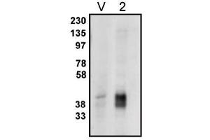 Image no. 1 for anti-Phosphatidic Acid Phosphatase Type 2C (PPAP2C) antibody (ABIN265044) (PPAP2C Antikörper)