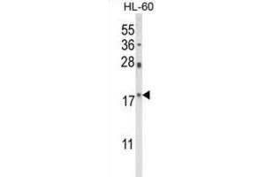 Western Blotting (WB) image for anti-Peptidylprolyl Cis/trans Isomerase, NIMA-Interacting 1 (PIN1) antibody (ABIN3003982) (PIN1 Antikörper)