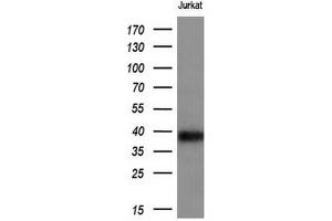 Western Blotting (WB) image for anti-T-cell surface glycoprotein CD1c (CD1C) antibody (ABIN2670676) (CD1c Antikörper)