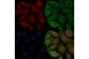 ABIN6255261 and ABIN6267114 staining Heat-shock treated Hela cells by IF/ICC. (EEF2K Antikörper  (pSer366))