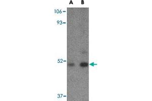 Western blot analysis of TBC1D10C in Daudi cell lysate with TBC1D10C polyclonal antibody  at (A) 1 and (B) 2 ug/mL . (Carabin Antikörper  (C-Term))