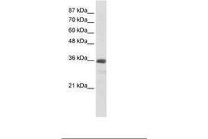 Image no. 2 for anti-U11/U12 SnRNP 35 KDa Protein (AA 29-78) antibody (ABIN203037) (SNRNP35 Antikörper  (AA 29-78))