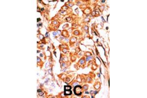 Immunohistochemistry (IHC) image for anti-Glycerol Kinase (GK) antibody (ABIN2995202) (Glycerol Kinase Antikörper)