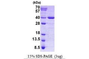 Image no. 1 for Axin Interactor, Dorsalization Associated (AIDA) protein (His tag) (ABIN1098551)