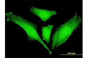 Immunofluorescence of monoclonal antibody to SLC2A4RG on HeLa cell. (SLC2A4RG Antikörper  (AA 178-269))