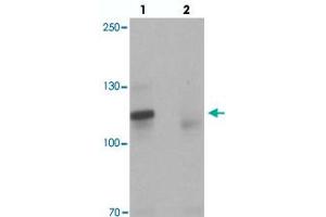 Western blot analysis of TSHZ3 in mouse brain tissue with TSHZ3 polyclonal antibody  at 1 ug/mL in (lane 1) the absence and (lane 2) the presence of blocking peptide. (TSHZ3 Antikörper  (N-Term))