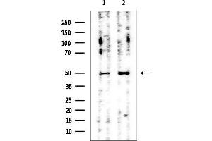Western blot analysis of lysates from various samples, using WTAP Mouse Monoclonal Antibody at 1/1000 dilution.