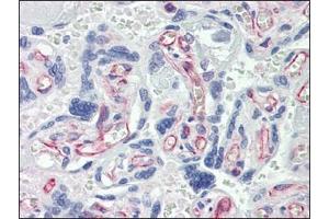 Immunohistochemistry (IHC) image for anti-Caspase 7, Apoptosis-Related Cysteine Peptidase (CASP7) antibody (ABIN614356) (Caspase 7 Antikörper)