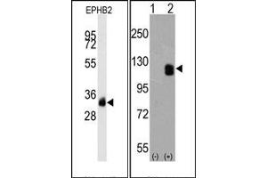 Western Blotting (WB) image for anti-EPH Receptor B2 (EPHB2) antibody (ABIN356401) (EPH Receptor B2 Antikörper)