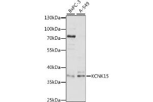 Western blot analysis of extracts of various cell lines, using KCNK15 antibody (ABIN7269466) at 1:1000 dilution.