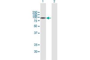 Western Blotting (WB) image for anti-Gelsolin (GSN) (AA 1-782) antibody (ABIN947935)