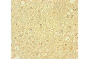 Immunohistochemistry of paraffin-embedded human brain tissue using ABIN7155318 at dilution of 1:100