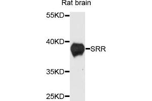 Western blot analysis of extracts of rat brain cells, using SRR antibody. (SRR Antikörper)