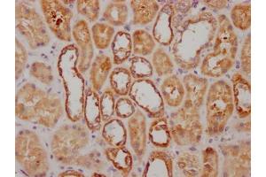 IHC image of ABIN7127638 diluted at 1:100 and staining in paraffin-embedded human kidney tissue performed on a Leica BondTM system. (Rekombinanter NDUFS3 Antikörper)