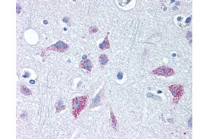Anti-WNT8B antibody IHC of human brain, cortex. (WNT8B Antikörper  (Internal Region))