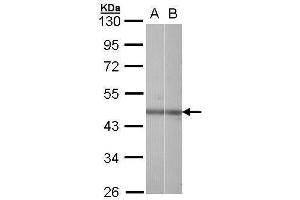 WB Image Sample (30 ug of whole cell lysate) A: Hela B: Raji 10% SDS PAGE antibody diluted at 1:1000 (NR2F6 Antikörper  (C-Term))