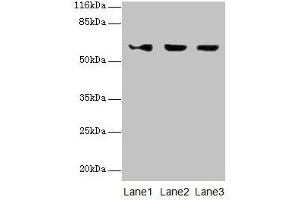 Western blot All lanes: ATL3 antibody at 2 μg/mL Lane 1: Jurkat whole cell lysate Lane 2: Hela whole cell lysate Lane 3: HepG2 whole cell lysate Secondary Goat polyclonal to rabbit IgG at 1/10000 dilution Predicted band size: 61 kDa Observed band size: 61 kDa (ATL3 Antikörper  (AA 1-187))