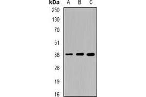 Western blot analysis of Sorbitol Dehydrogenase expression in HT29 (A), mouse liver (B), mouse kidney (C) whole cell lysates. (SORD Antikörper)