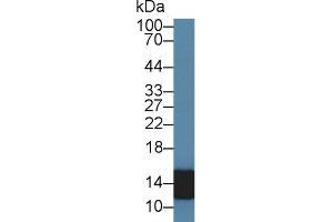 Detection of S100A8 in Human Leukocyte lysate using Polyclonal Antibody to S100 Calcium Binding Protein A8 (S100A8) (S100A8 Antikörper  (AA 1-89))