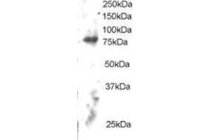 Western Blotting (WB) image for anti-Engulfment and Cell Motility 2 (ELMO2) (C-Term) antibody (ABIN2465647) (ELMO2 Antikörper  (C-Term))