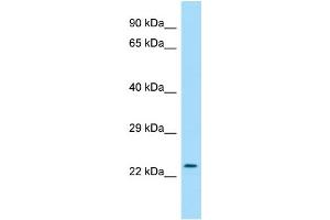 WB Suggested Anti-RAB30 Antibody Titration: 1. (RAB30 Antikörper  (C-Term))
