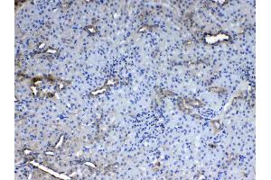 IHC analysis of CD151 using anti- CD151 antibody . (CD151 Antikörper  (AA 113-175))