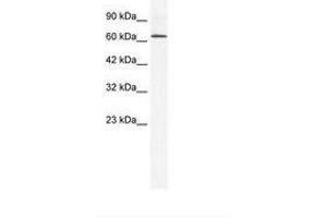 Image no. 1 for anti-DEAD (Asp-Glu-Ala-Asp) Box Polypeptide 21 (DDX21) (C-Term) antibody (ABIN202915) (DDX21 Antikörper  (C-Term))
