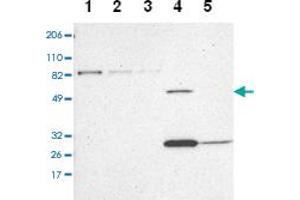 Western blot analysis of Lane 1: RT-4, Lane 2: U-251 MG, Lane 3: A-431, Lane 4: Liver, Lane 5: Tonsil with ZNF75A polyclonal antibody at 1:100-1:250 dilution. (ZNF75A Antikörper)