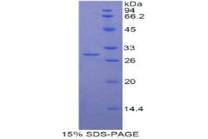 SDS-PAGE (SDS) image for Myosin IG (MYO1G) (AA 769-1016) protein (His tag) (ABIN1877769)