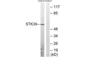 Western blot analysis of extracts from COLO cells, using STK39 (Ab-311) antibody. (STK39 Antikörper  (Ser311))