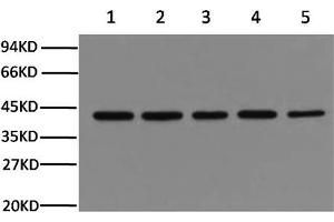 Western Blotting (WB) image for anti-Actin, beta (ACTB) antibody (ABIN5958070) (beta Actin Antikörper)