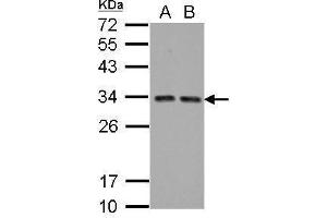 WB Image Sample (30 ug of whole cell lysate) A: A431 B: HeLa 12% SDS PAGE antibody diluted at 1:5000 (HIV-1 Tat Interactive Protein 2, 30kDa (HTATIP2) Antikörper)