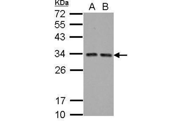 HIV-1 Tat Interactive Protein 2, 30kDa (HTATIP2) antibody