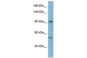 ATP2A1 antibody used at 1 ug/ml to detect target protein. (ATP2A1/SERCA1 Antikörper  (N-Term))