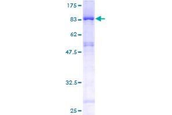 EDC3 Protein (AA 1-508) (GST tag)