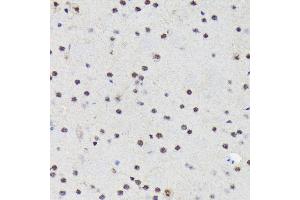 Immunohistochemistry of paraffin-embedded mouse brain using PRP19 Rabbit mAb (ABIN7269505) at dilution of 1:100 (40x lens). (PRP19 Antikörper)
