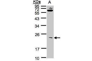 WB Image Sample(30 ug whole cell lysate) A:293T 12% SDS PAGE antibody diluted at 1:1000 (UBE2M Antikörper)