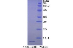 SDS-PAGE analysis of Human Selenoprotein W1 Protein. (Selenoprotein W Protein)